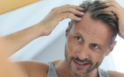 Platelet Rich Plasma (PRP) Hair loss treatment