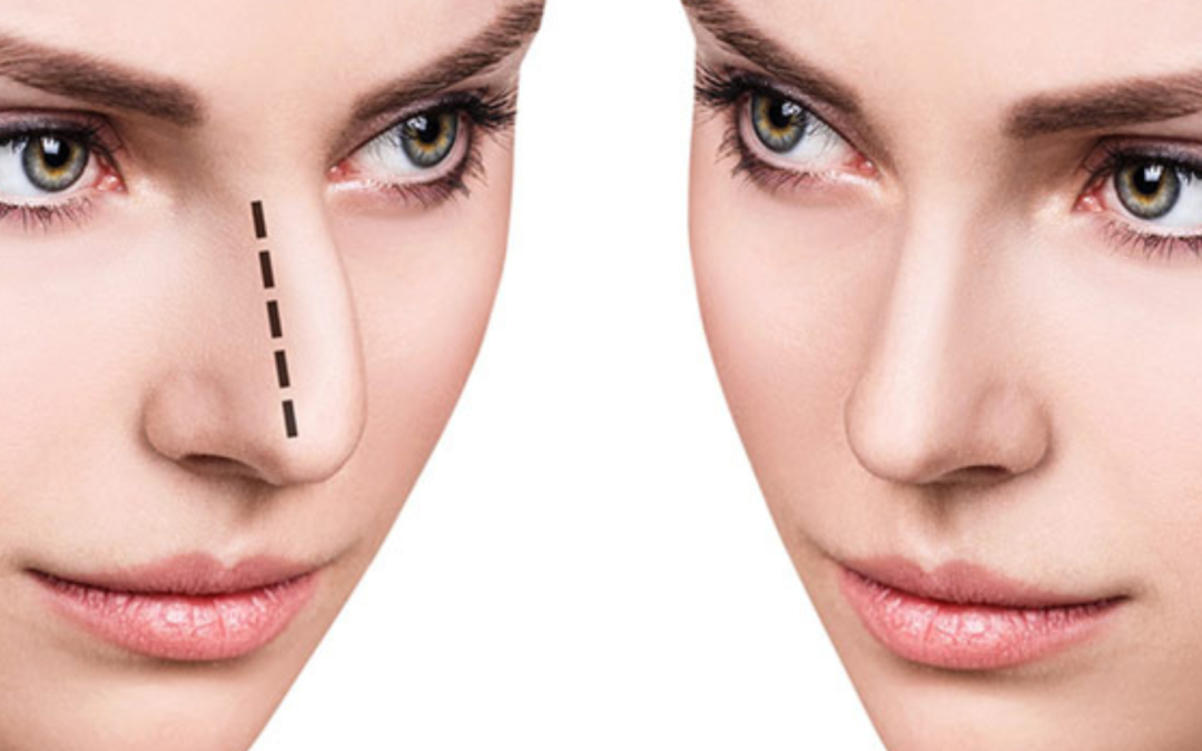 What is the difference between surgical and nonsurgical?