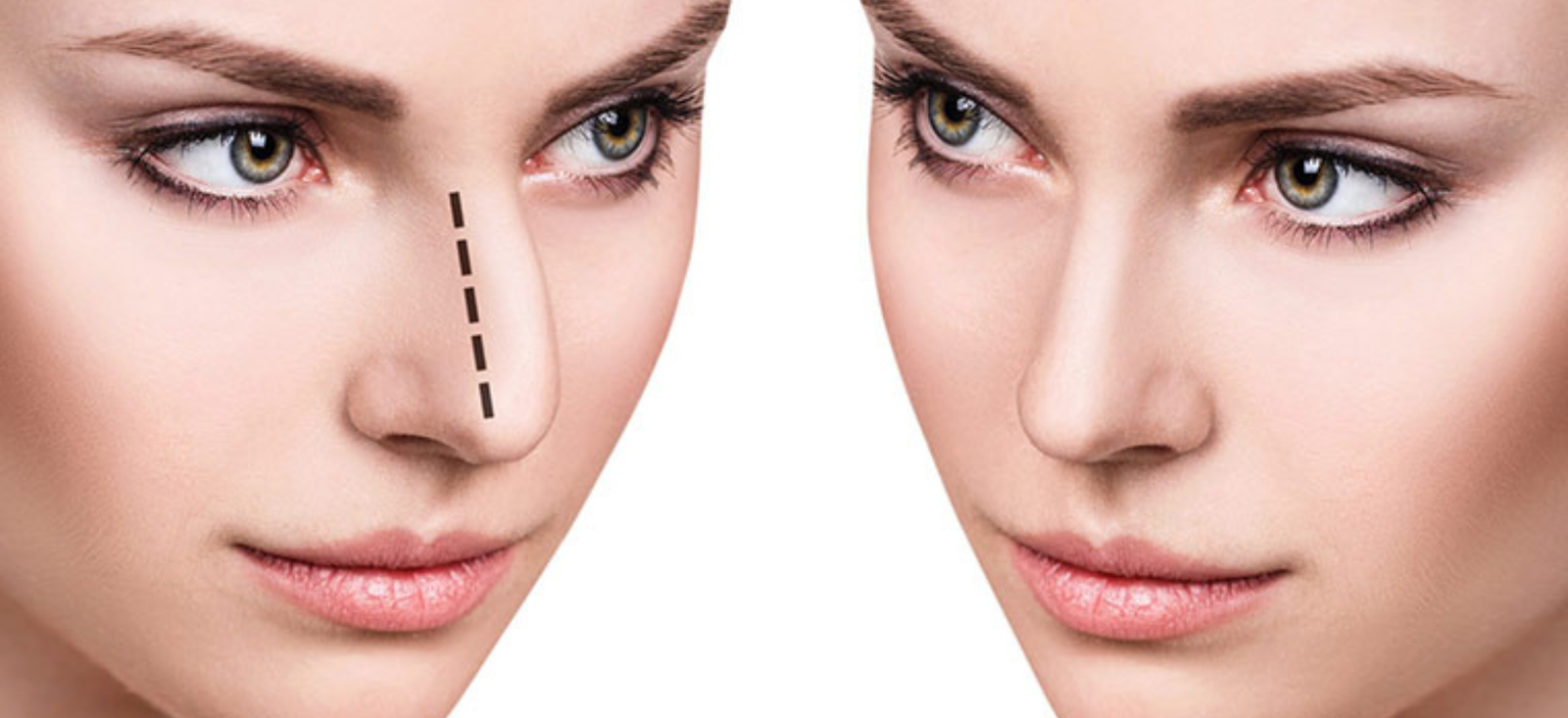 surgical and nonsurgical