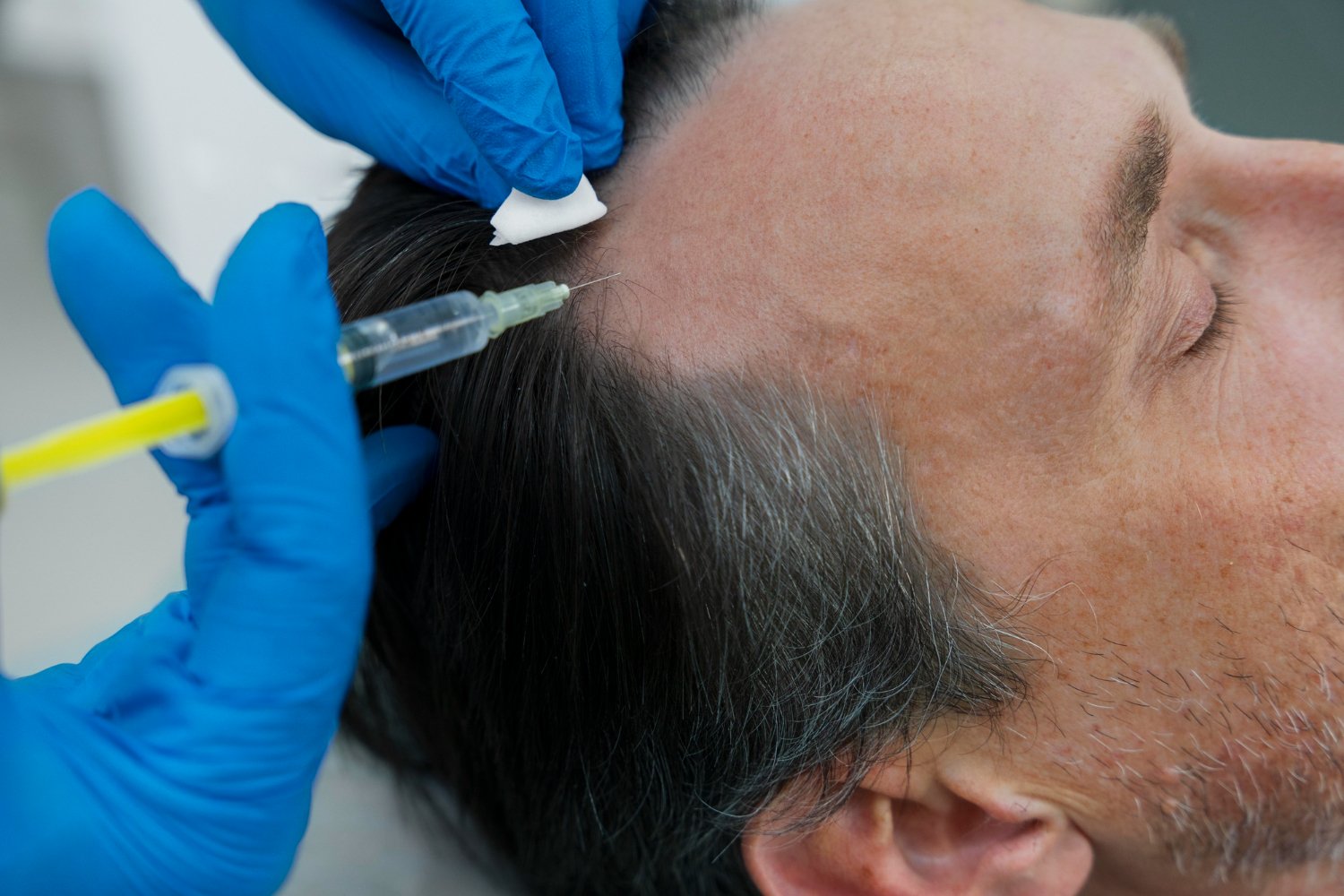 What is PRP (Platelet Rich Plasma)?