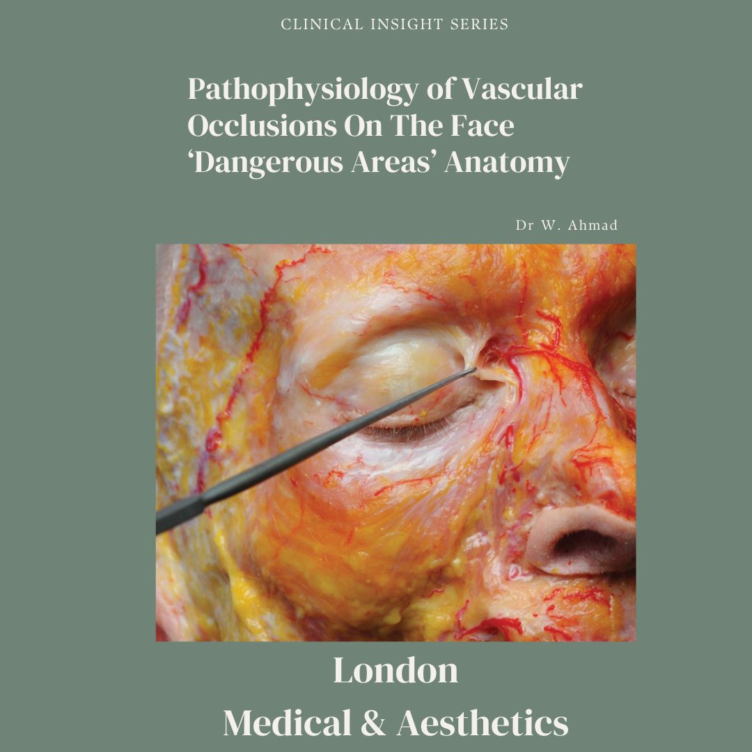 Pathophysiology of Vascular Occlusions On The Face
