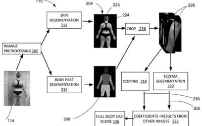 Belle.ai patents AI platform for evaluating, tracking skin conditions